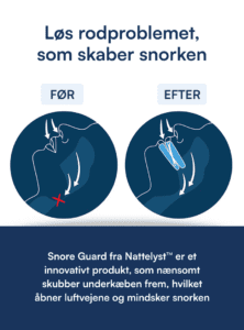 Snore Guard (Bideskinne mod Snorken)