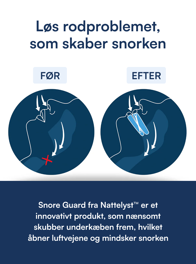 Snore Guard (Bideskinne mod Snorken)