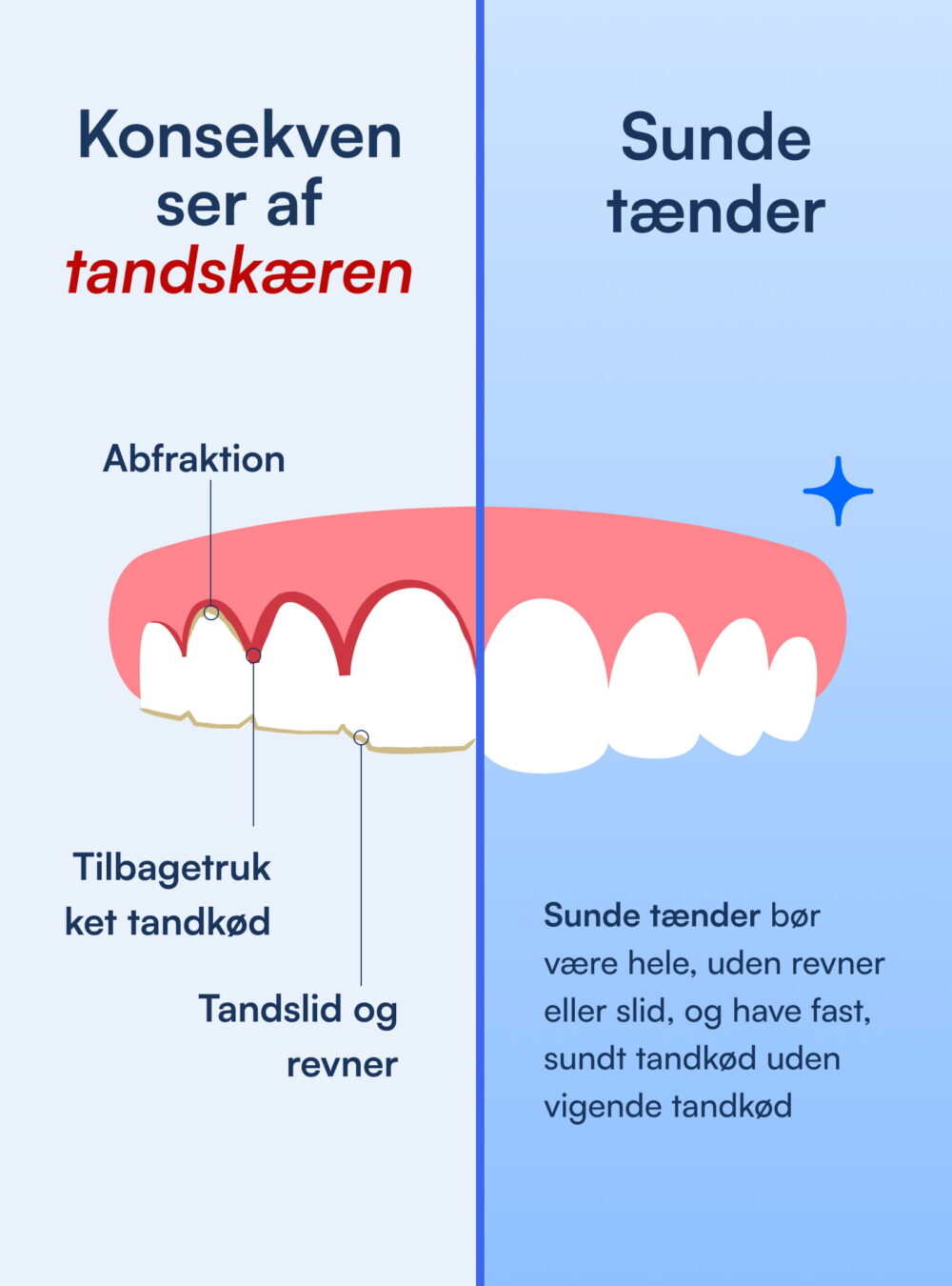 Grind Guard (Mod Tandskæren)