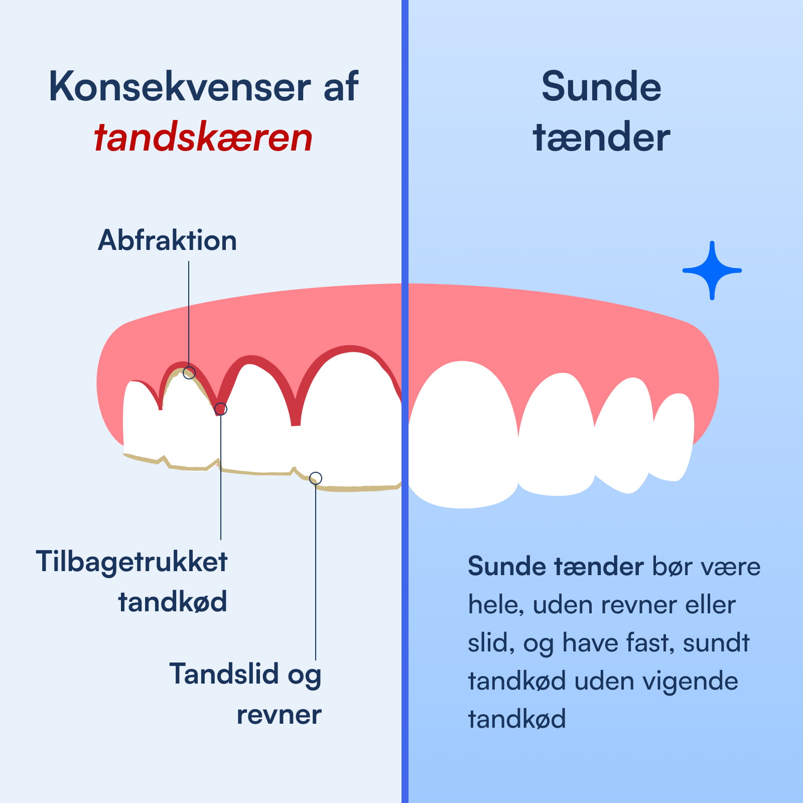 Kontrast: slidte tænder med affraktion og tilbagetrukket tandkød vs sunde hele tænder med fast tandkød